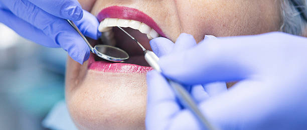 Best Emergency Root Canal Treatment in St Martinville, LA